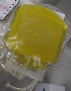 fresh frozen plasma blood component storage